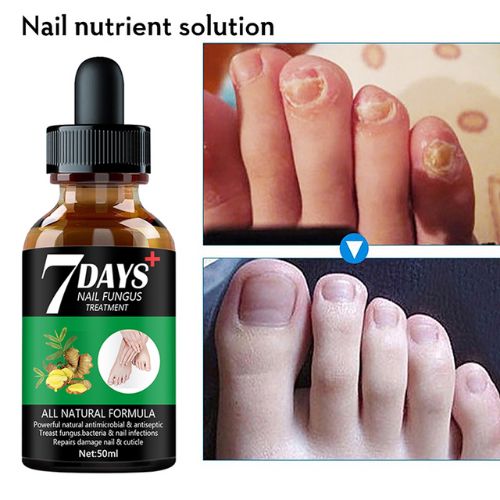 Foot Nail Fungus Treatment Serum